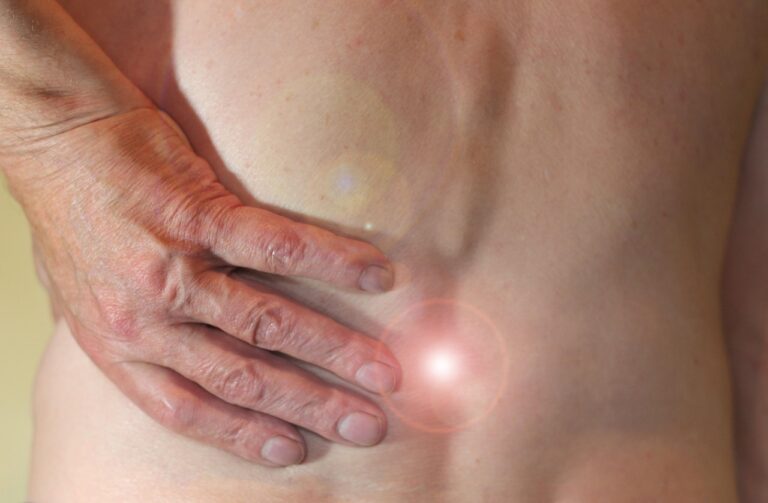 The Back Hand Pains