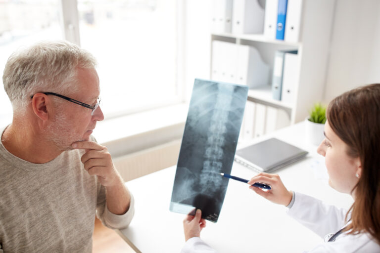 medicine, healthcare, surgery, radiology and people concept - doctor showing x-ray of spine to senior man at hospital