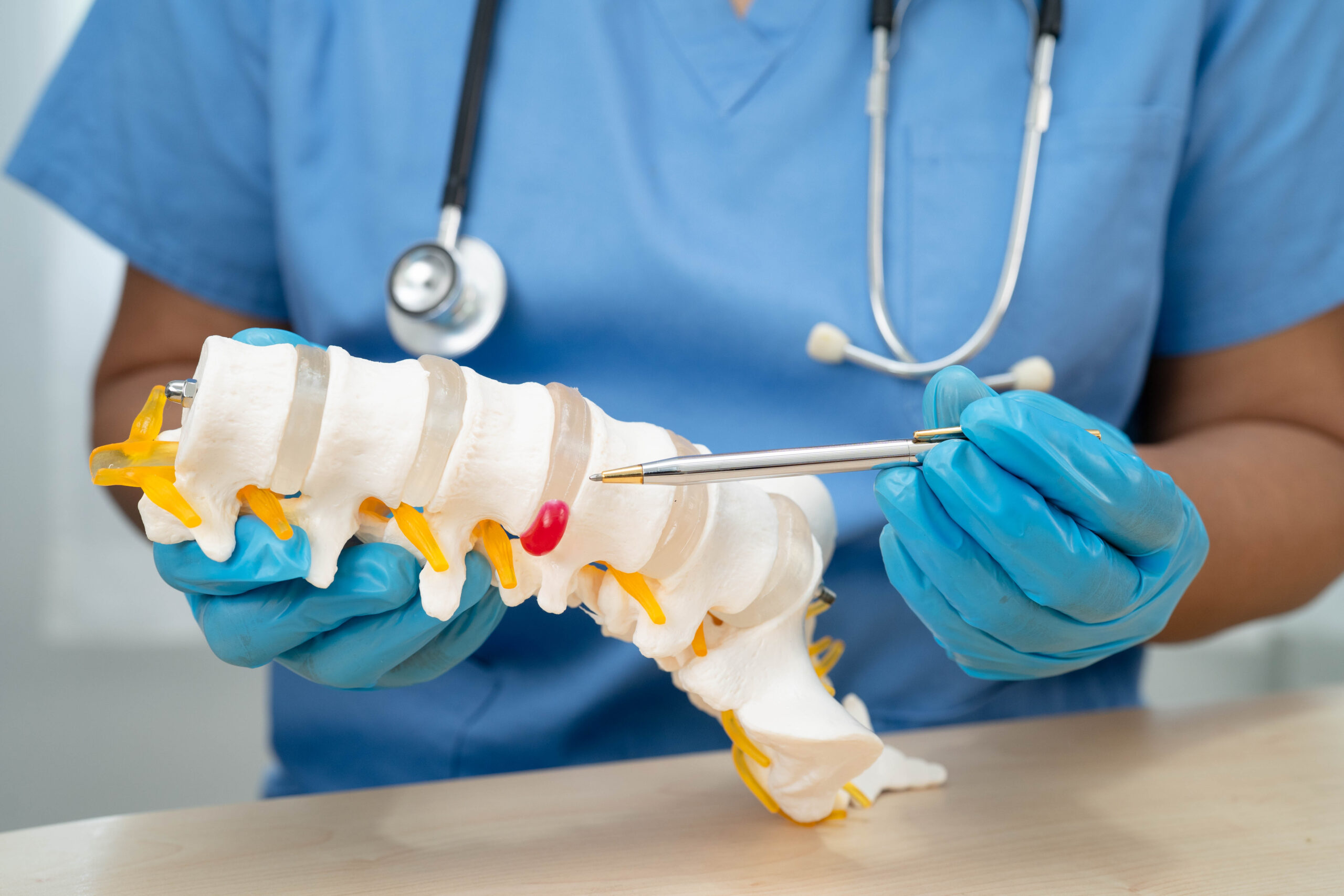 Asian doctor holding spinal nerve and bone model, Lumbar spine displaced herniated disc fragment for treatment medical in the orthopedic department.