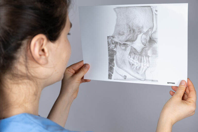The doctor holds a CT scan of a patient with temporomandibular joint dysfunction and malocclusion