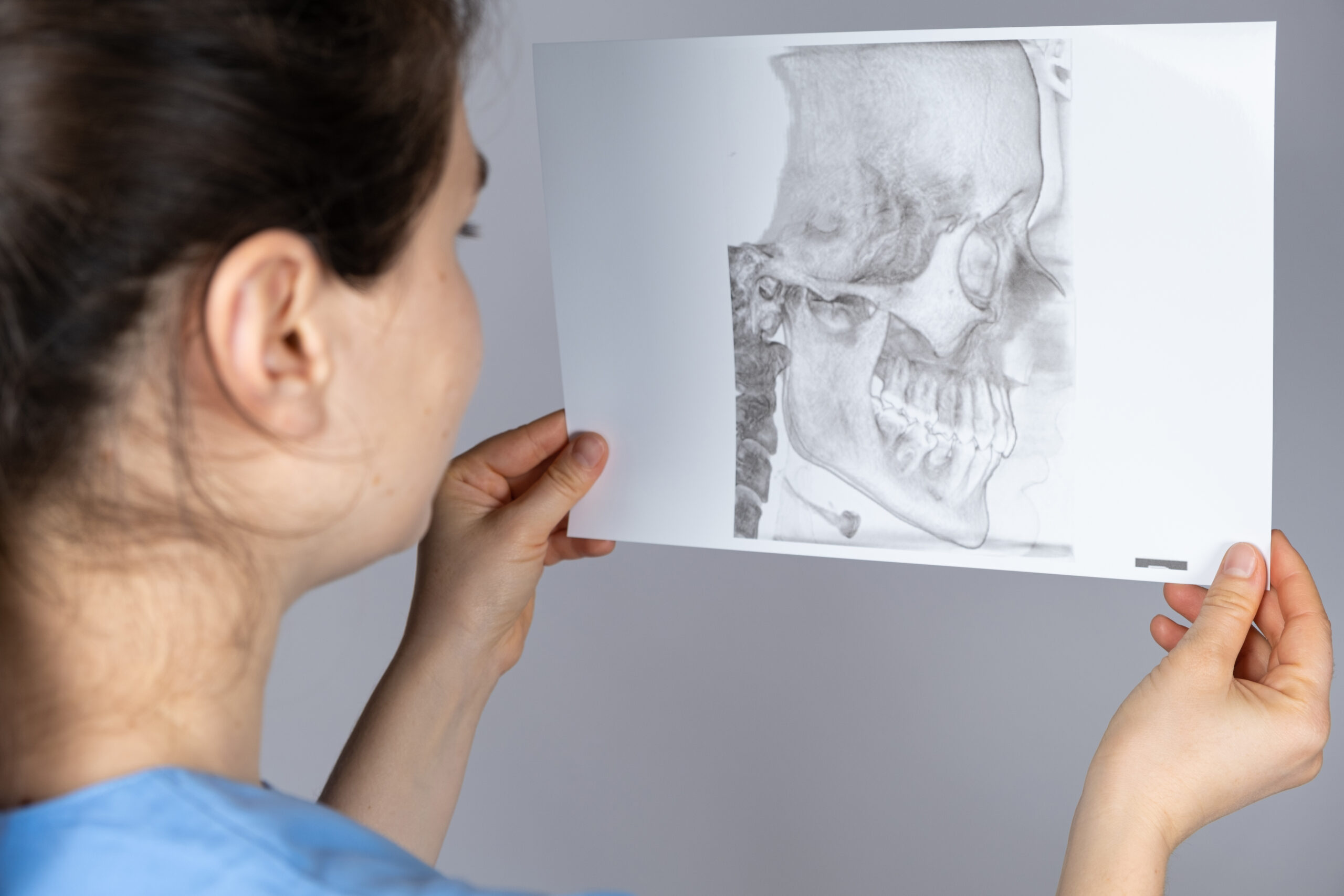 The doctor holds a CT scan of a patient with temporomandibular joint dysfunction and malocclusion